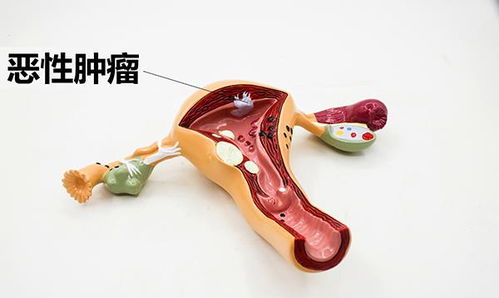 揭秘命运冠位指定医生：背后的真相和故事